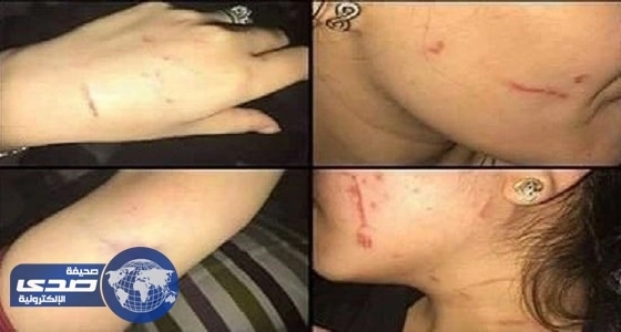 بالصور.. عضو ببلدي القطيف يكشف تفاصيل 7 محاولات إرهابية استهدفته