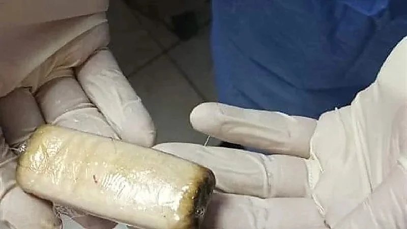 سجين يبتلع هاتف محمول ملفوف بكيس!