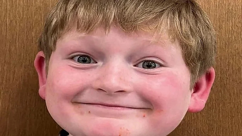 3 كلاب ضالة هاجموا طفلاً ومزقوا فروة رأسه أثناء ركوبه الدراجة