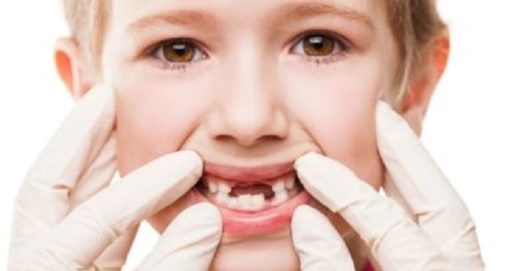 3 أسباب دليل إصابتك بخراج الفم