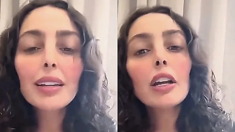 فاطمة الصفي: أنا ما سويت تكميم معدة أنا سويت قص لجلدي  ..  فيديو