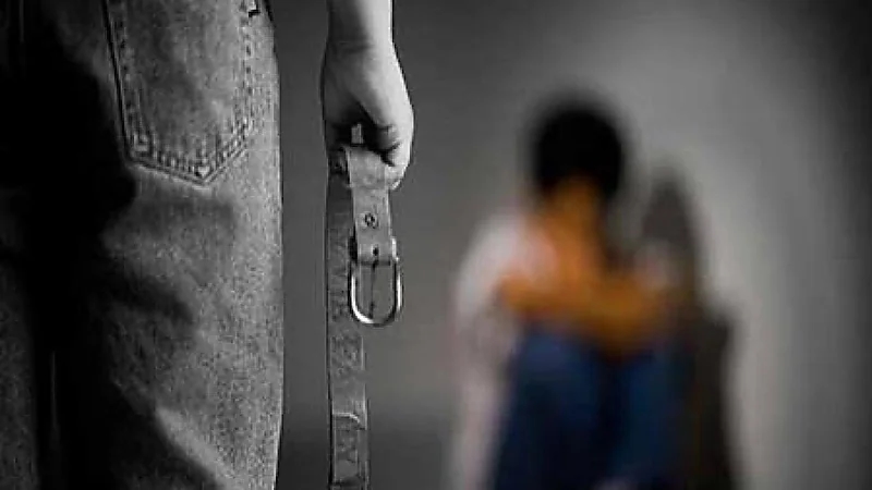 أب يحرق ابنه بسبب 100 دينار