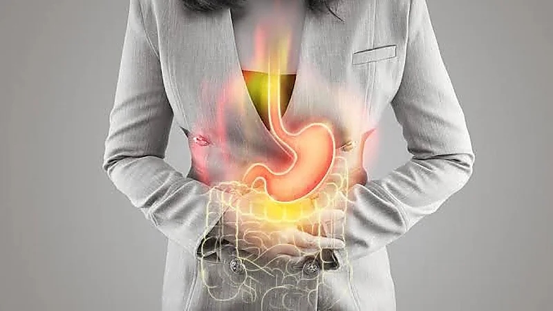 أخصائي : نصيحة منزلية فعالة للتخلص من الحموضة وارتجاع المريء .. فيديو