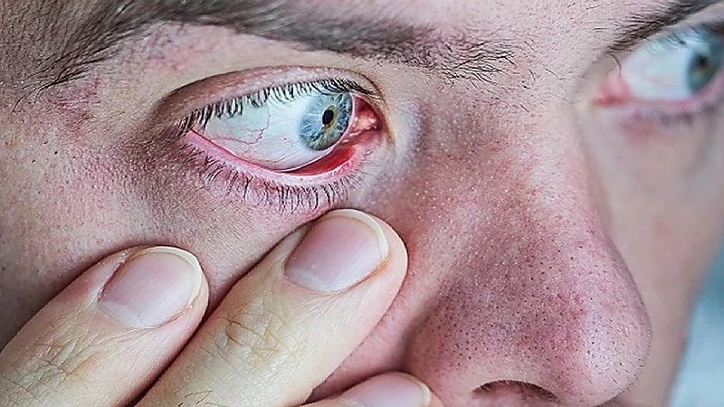 علامات في العين تكشف عن أعراض مبكرة للخرف