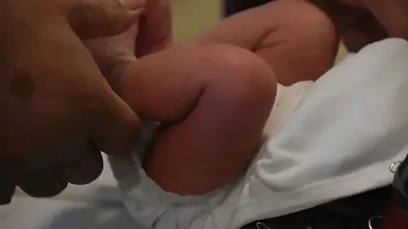 وفاة رضيعة بختان يثير غضبًا واسعًا في غامبيا