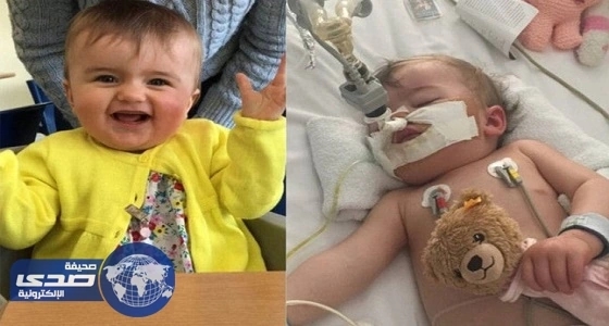 خطأ طبي يكلّف طفلة جزءًا من نظرها وسمعها