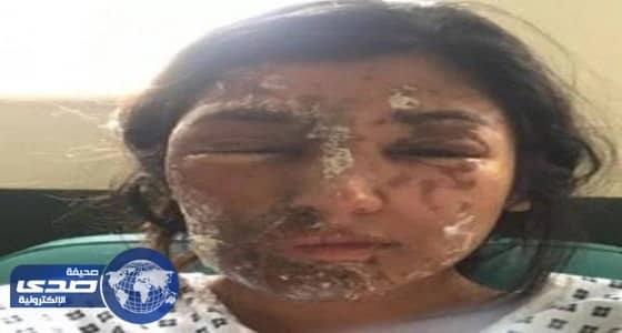 " تقنية رنية " تفتتح تخصص " المحركات والمركبات " بشروط