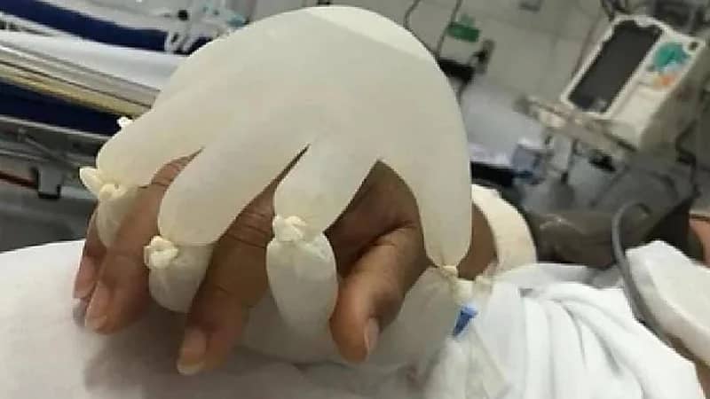 مستشفى تخفف معاناة مرضى كورونا بفكرة رائعة