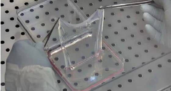 عملية معقدة تنقذ حياة طفل سوري من الموت بألمانيا