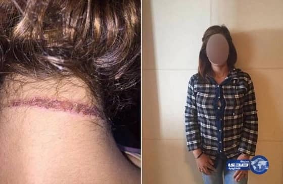 السيطرة على حريق بصيدلية خاصة فى ابو عريش