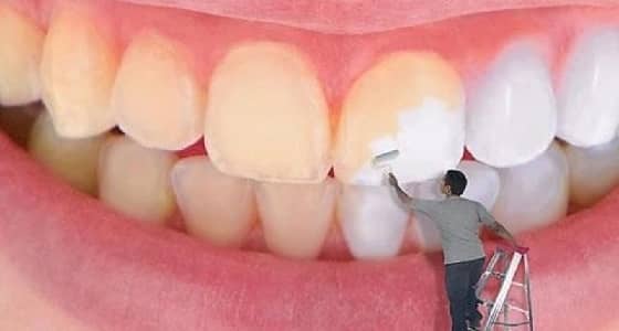 " القرنفل " و " البصل " للقضاء على إصفرار الأسنان