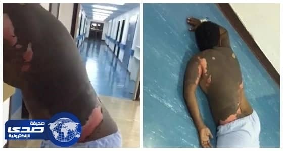 " حارقة زوجها " بالزيت المغلي ترفع دعوى سب وتشهير ضده