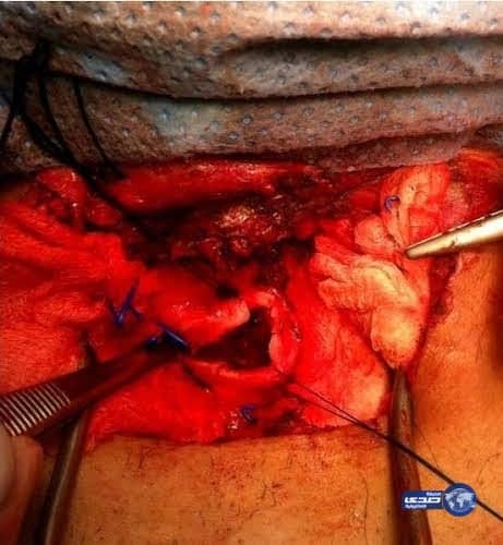 مؤرخ: منطقة جامع عبدالله بن العباس بالطائف مقبرة قديمة