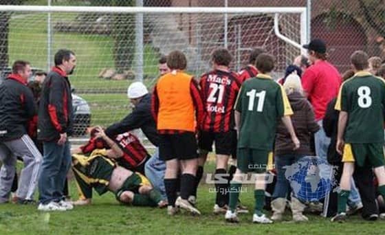 لاعب أرجنتيني يتعرض لإصابة في الجمجمة بعد ضربة من زميله