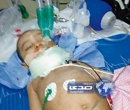 عنف جسدي يدخل رضيعا في غيبوبة