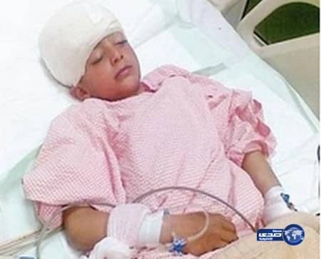نجاح عملية فتح جمجمة لفتاه في مستشفى طريف العام‎