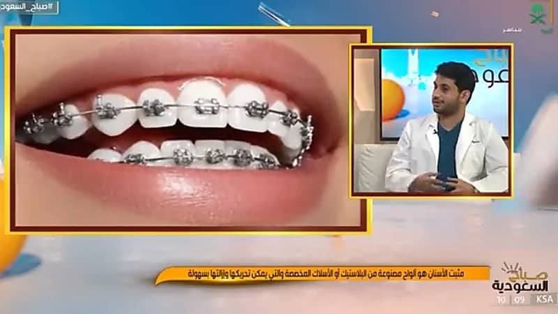 "طبيب أسنان" يوضح أنواع التقويم وأشكاله وخصائصه (فيديو)
