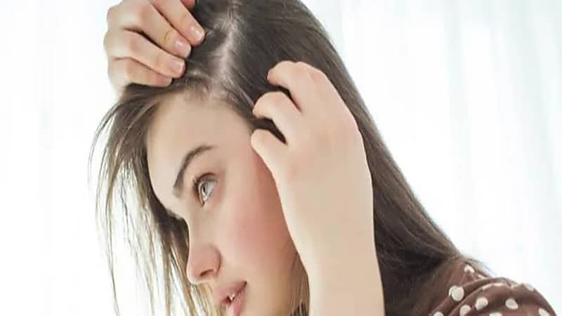 عوامل تزيد من احتمالية الإصابة بالثعلبة