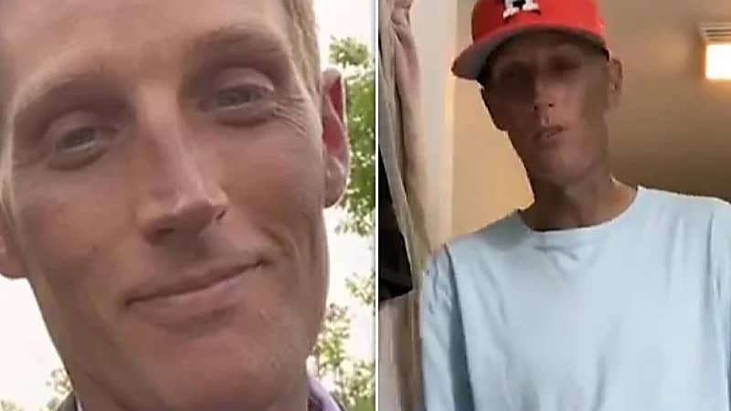 بالفيديو.. لون جلد شاب يتحول من الأبيض للأسود بسبب عقار