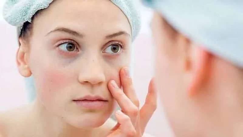 بالفيديو.. استشاري يكشف أهم العوامل المسببة للإصابة بـ "الذئبة الحمراء"