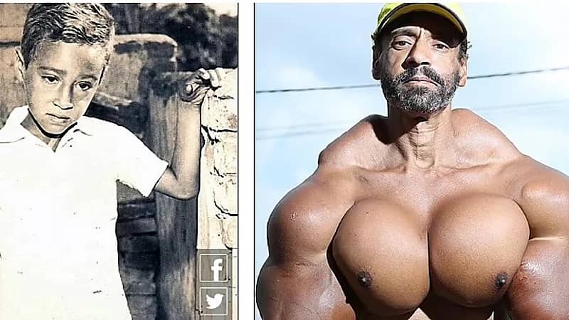 وفاة لاعب كمال أجسام شهير بسبب حقن عضلاته بالزيت الخطير