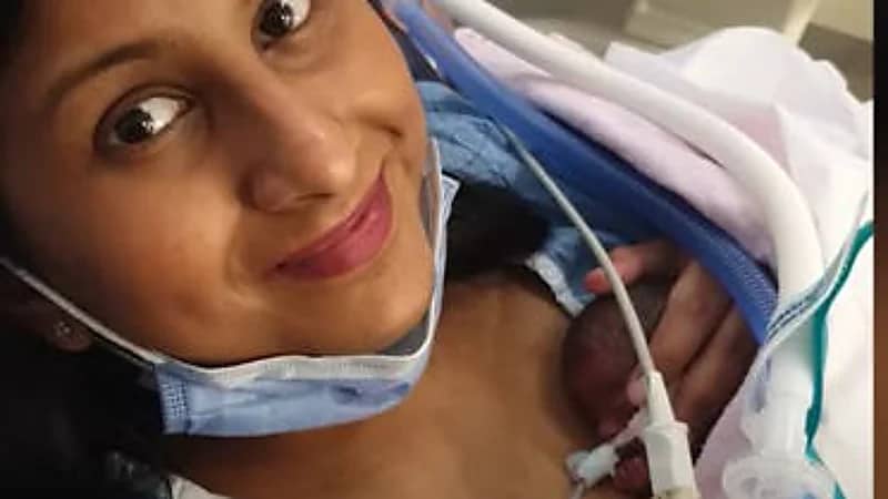 شاهد.. توأم بحجم كف اليد يدخل موسوعة جينيس