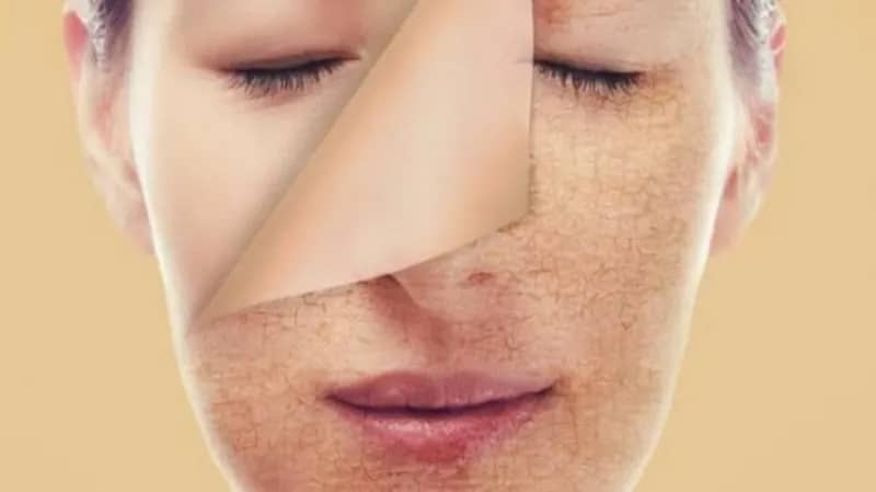 طرق التغلب على مشكلة جفاف البشرة خلال رمضان