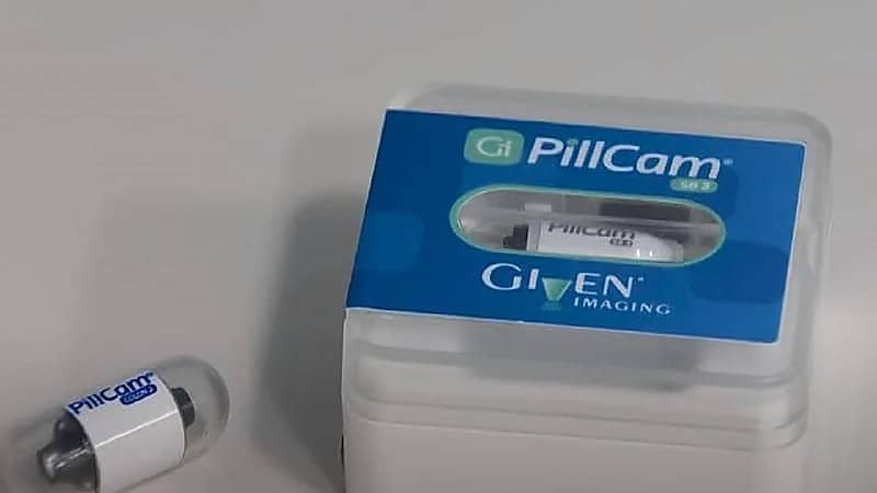 ابتكار طريقة جديدة لاكتشاف سرطان القولون