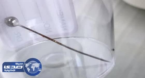استخراج إبرة خياطة من مريء طفل بمستشفى الولادة ببريدة