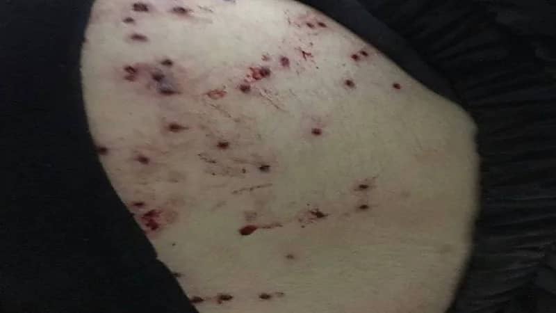 مرتزقة "الملالي" يطلقون 38 رصاصة على مراهقة