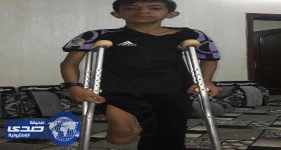 بالفيديو.. صحة المدينة: الطبيب المتسبب في بتر قدم طفل لم يهرب