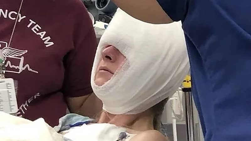 دب متوحش يفتك بجمجمة سيدة وينهش وجهها