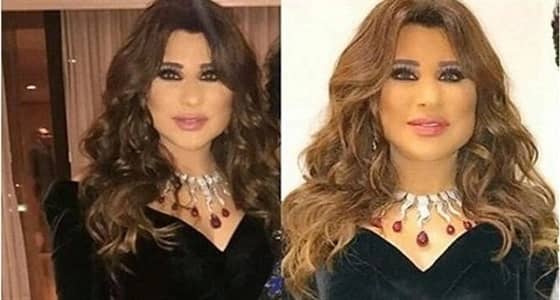 بالفيديو.. نجوى كرم تكشف عن سبب تورم وجهها