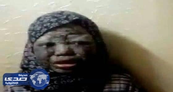 تفاعل المغردين ينقذ طفلة مصابة بمرض عضال ..فيديو