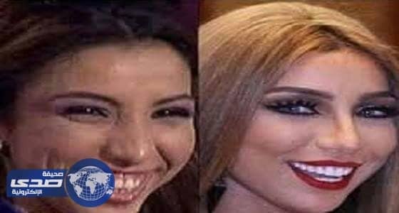 بالفيديو.. دنيا بطمة داخل عيادة تجميل لحقن البوتوكس