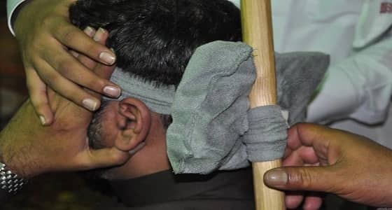 " الوطني للطب البديل " : العلاج بشد الرأس غير مثبت علميا