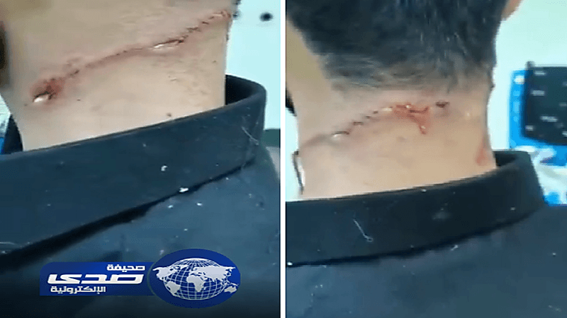 بالفيديو.. ذئب يهاجم شابًّا في حائل