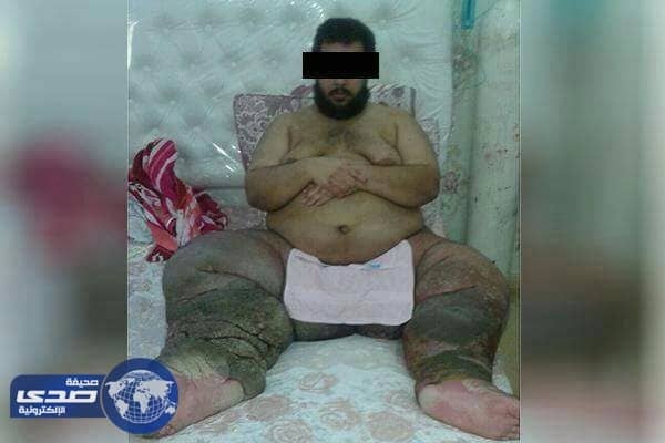 المالكي ينشر صورة شاب منعه مرضه من أداء الصلاة إلا في هذا الوضع