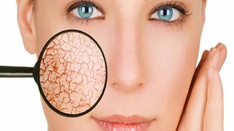 10 خطوات لتجنب جفاف البشرة خلال شهر رمضان