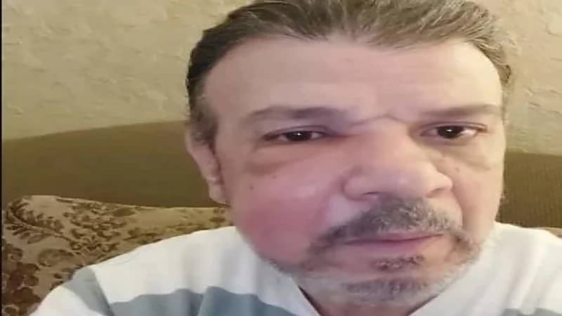 أحمد سلامة يظهر بوجه متورم ويثير قلق جمهوره 