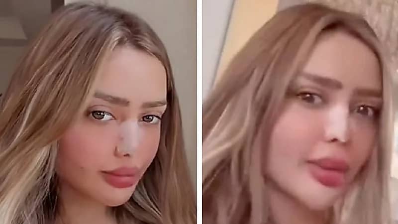 مروج الرحيلي ترد على متابعة انتقدت تجميلها .. فيديو