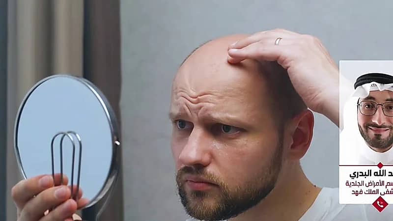 استشارى: الثوم يضاعف مشكلة الثعلبة ولا يوصي باستخدامه إطلاقا ..فيديو