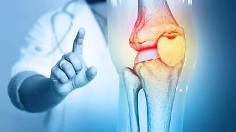 ابتكار مادة هلامية جديدة لتجديد العظام باستخدام الضوء المرئي