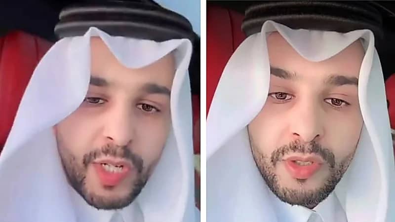 الشهري يوضح أبرز أسباب ارتجاع المريء وطرق الوقاية منه .. فيديو