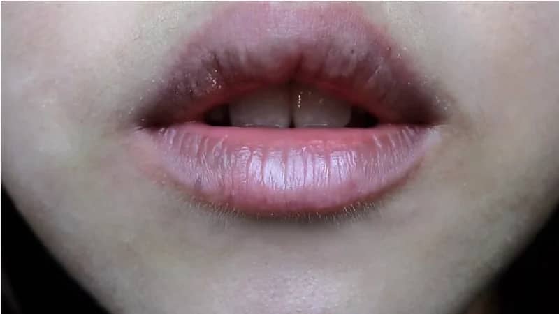 أسباب سواد الشفاه الشائعة وطرق التعامل معه