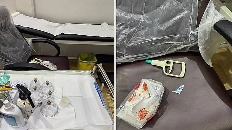 ضبط مقيمة عربية تمارس الحجامة دون ترخيص بحفر الباطن