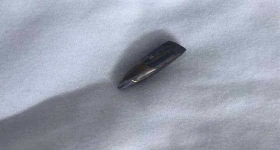 نقل " الجدوع " إلى مستشفى بالرياض بعد إخراج الرصاصة من كتفه