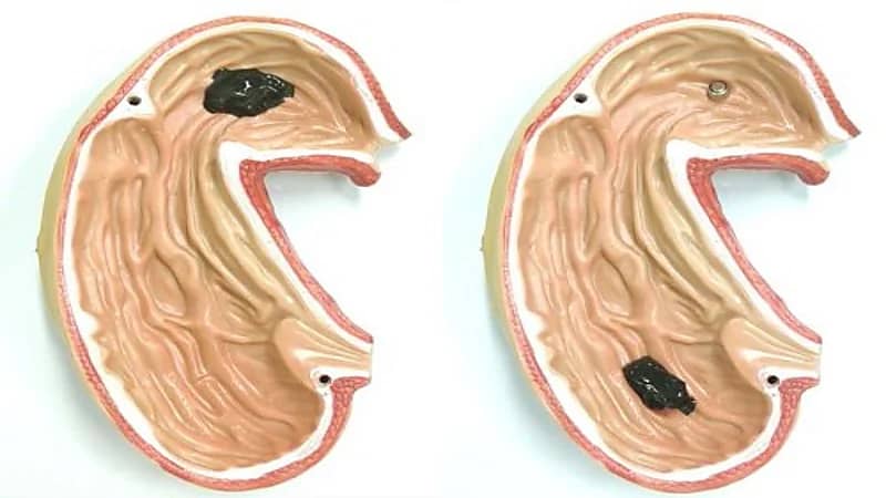 تطوير روبوت يخترق الجسم البشري