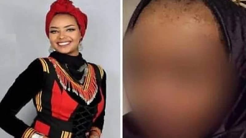 حلق شعر إجباري للفنانة اليمنية "انتصار الحمادي"