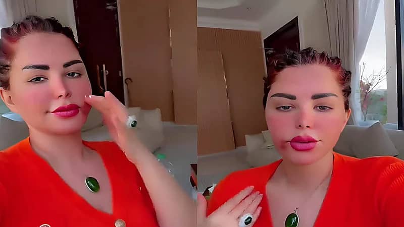 شمس الكويتية تكشف عن تورم وجهها بسبب قلقها على والدتها.. فيديو